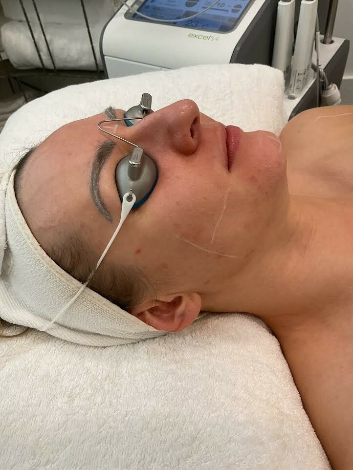 Laser Genesis facial treatment